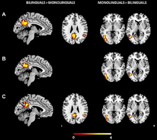 Foto: Áreas del cerebro activadas en bilingües y en monolingües / tendencias21.net