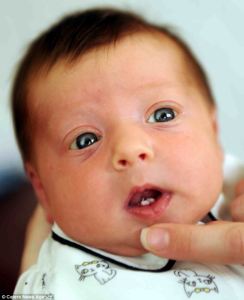 Bebé nace con un par de dientes blancos y brillantes (Fotos)