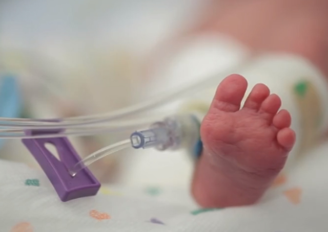 Padre registra la lucha de su bebé prematuro por sobrevivir (Video + Awww)