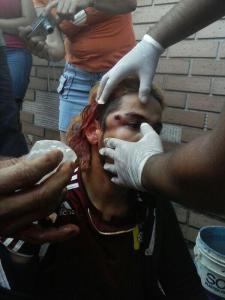 Ya no son perdigones: GNB dispara METRAS a manifestantes (imágenes fuertes)
