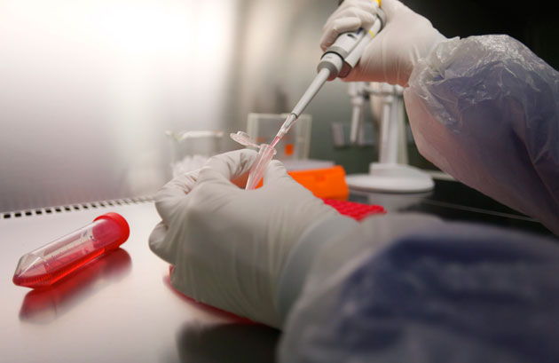 Bionalistas: 50% de hospitales no cuentan con servicio de bacteriología