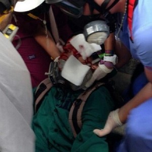 Jóvenes heridos con metras en Chacao #17A (Fotos)