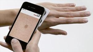 Lanzan una app para controlarte el cáncer de piel