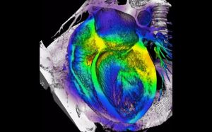 Con trasplante celular se puede reparar un corazón infartado