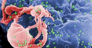 Científicos descubren unos genes que fulminan el VIH