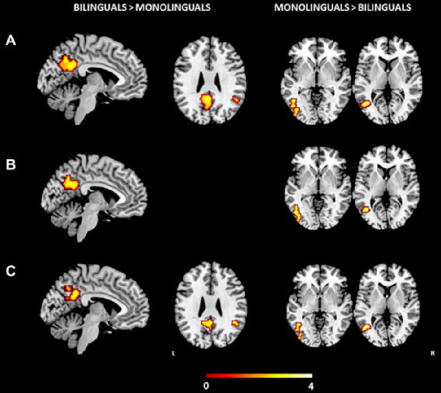 ¿En qué se diferencian los cerebros de las personas bilingües de los que no lo son?