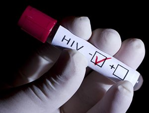 Desarrollan clones de anticuerpos contra el VIH