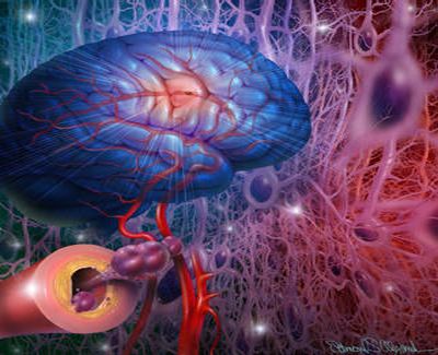 El ruido del tráfico aumenta riesgo de enfermedades cardiovasculares