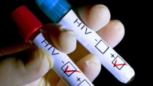 La vacuna contra el sida podría ser administrada a partir del 2016