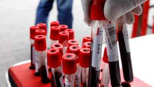 En Nueva Esparta, bancos de sangre no reciben donantes por escasez de reactivos