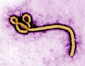 Estudio revela que el ébola puede permanecer en sobrevivientes hasta nueve meses