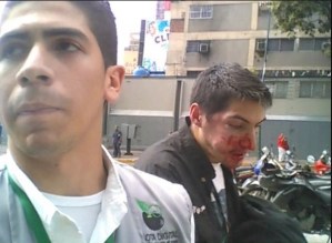 FOTOS: Estos son los integrantes de “colectivos de paz” que agredieron a periodista de La Patilla