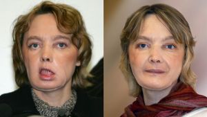 Muere la mujer francesa que recibió el primer trasplante mundial de cara