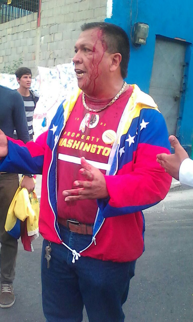 Reportan tres heridos en manifestación de Trujillo
