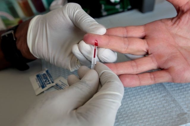 ONGs denuncian escasez de recursos médicos para tratar VIH/sida