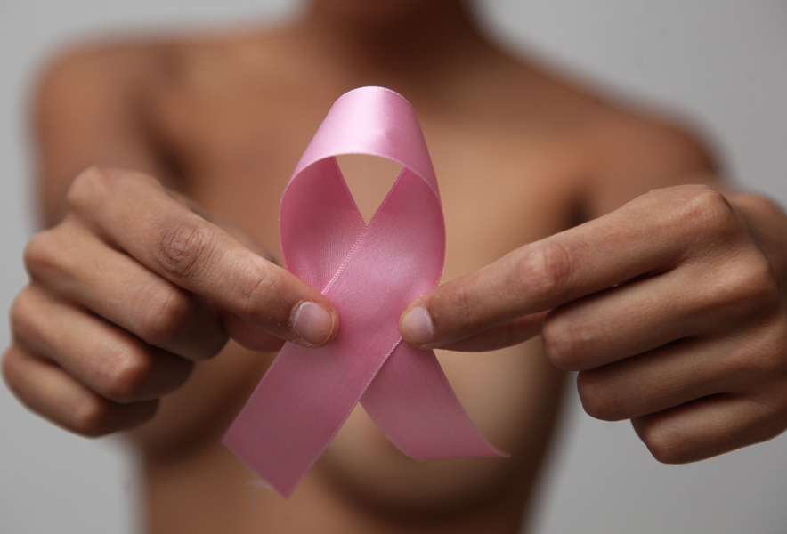 Prevención del cáncer de mama: ¿Qué puedes hacer para disminuir el riesgo?