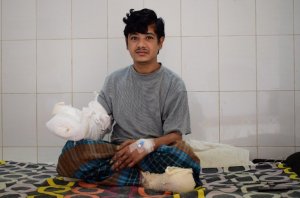 Médicos esperan dar el alta al “hombre árbol” de Bangladesh en un mes