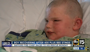 Este niño asegura que sobrevivó al ataque de 400 abejas usando una técnica de Dragon Ball Z