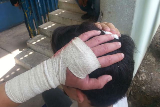 Heridos por perdigón en protesta de la Unet | Foto: Mariana Duque / El Pitazo