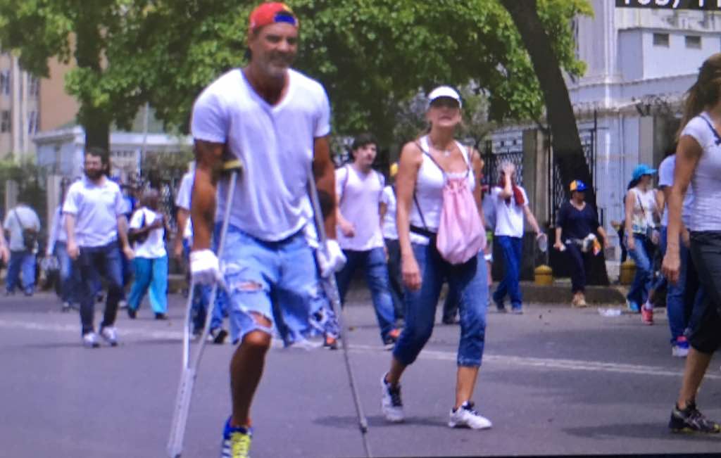 Le falta una pierna, pero le sobran ganas por una Venezuela libre. ¡Nuestro respeto! #22A (foto)