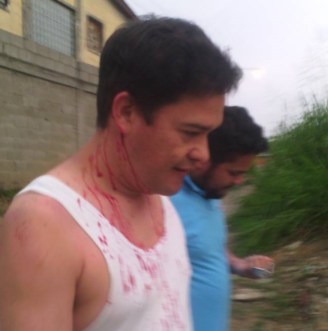 Paramilitares agredieron a manifestantes que realizaban plantón en Trujillo #24A