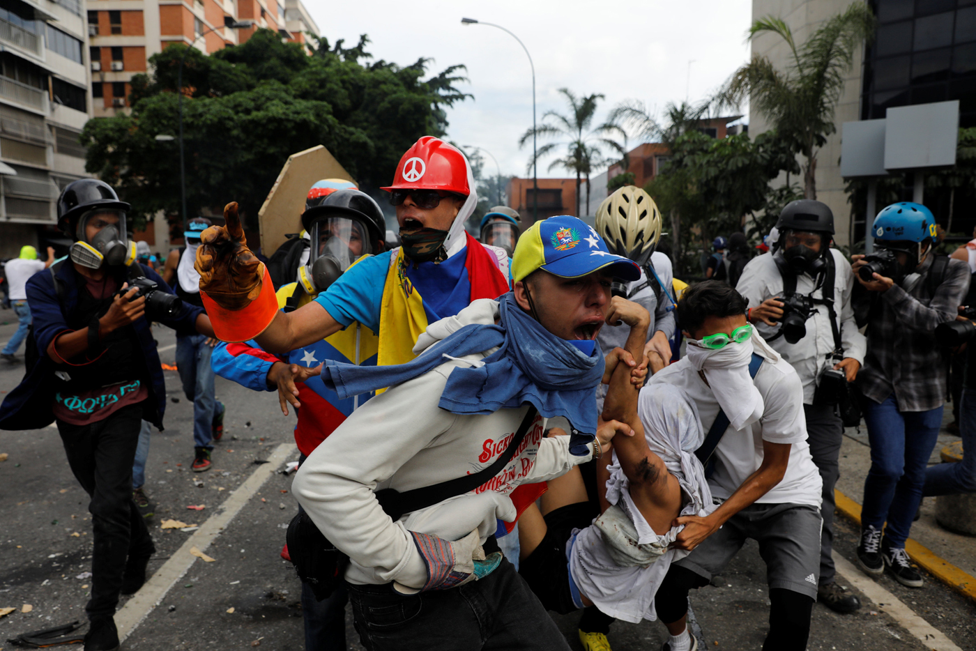 398 manifestantes heridos dejó represión en Caracas este #3May