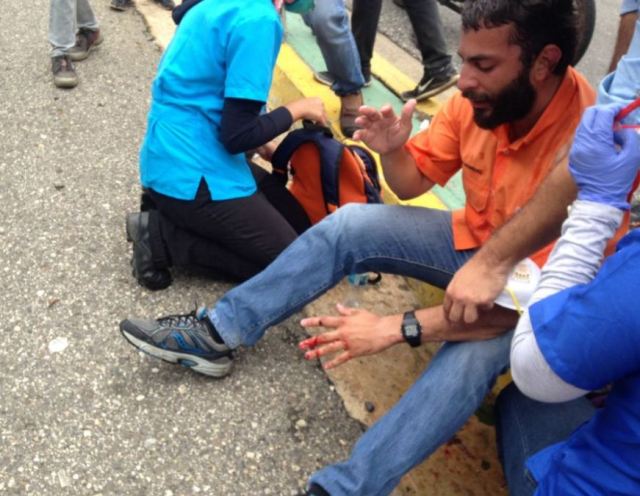 El dirigente fue impactado por una lacrimógena en una de sus manos. Foto: @caraboboadiario