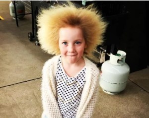 Síndrome del cabello impeinable SÍ existe: Niña vive con esta inusual condición (fotos)