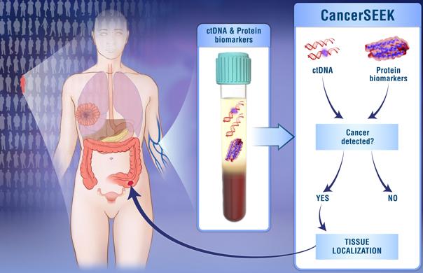 Examen de sangre experimental detecta cáncer de forma precoz