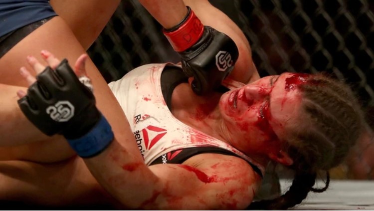 El impactante y sangriento nocaut de la luchadora más prometedora de la UFC (Videos)