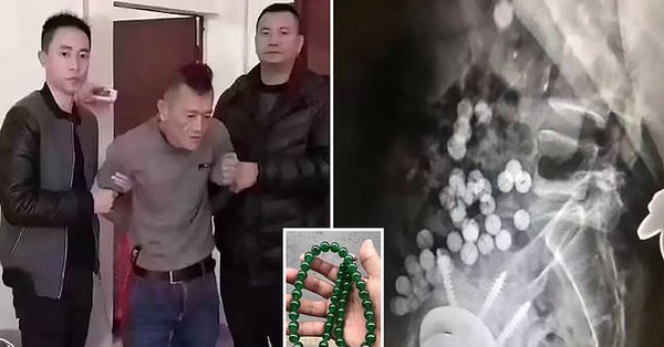 Un ladrón se traga un collar de 1,4 millones de dólares para evitar ser arrestado