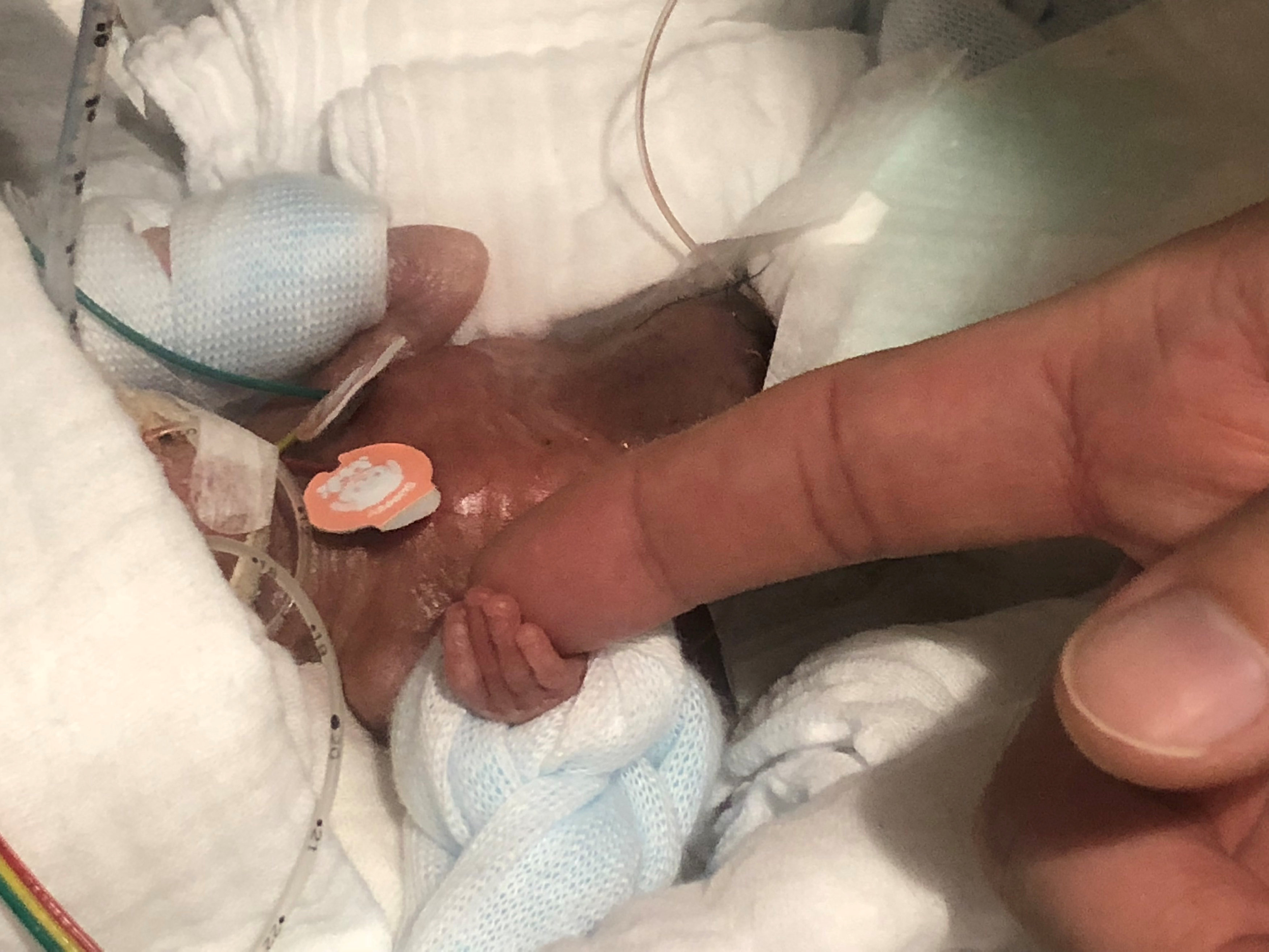 Un bebé que nació pesando 268 gramos, deja el hospital sano y salvo (fotos)
