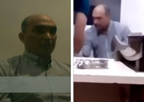 Las imágenes que podrían probar cómo inyectaron al coronel García Palomo antes de la “confesión” (VIDEO)