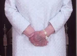 La mano magullada de la reina Isabel (fotos)