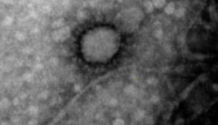 Por primera vez lograron fotografiar el coronavirus que circula en Argentina