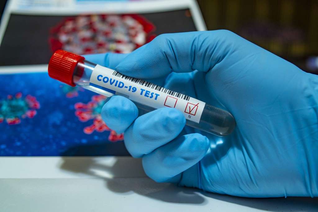 Los casos en Florida superan los 38.800 y las muertes alcanzan 1.600 por coronavirus