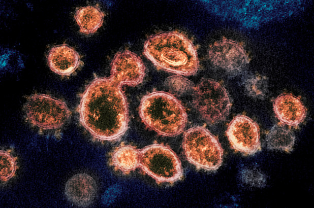 ¿La misma de Reino Unido? Identifican en Brasil una nueva cepa del coronavirus