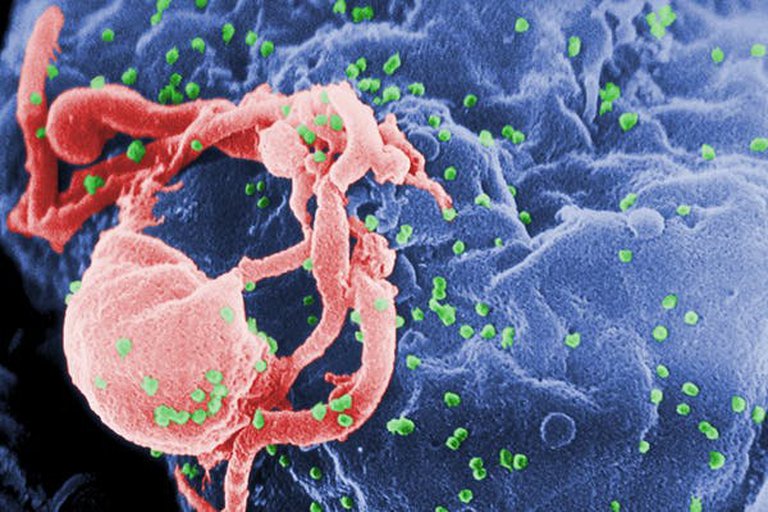 La ONU pronostica hasta 148 mil muertes adicionales por sida hasta 2022