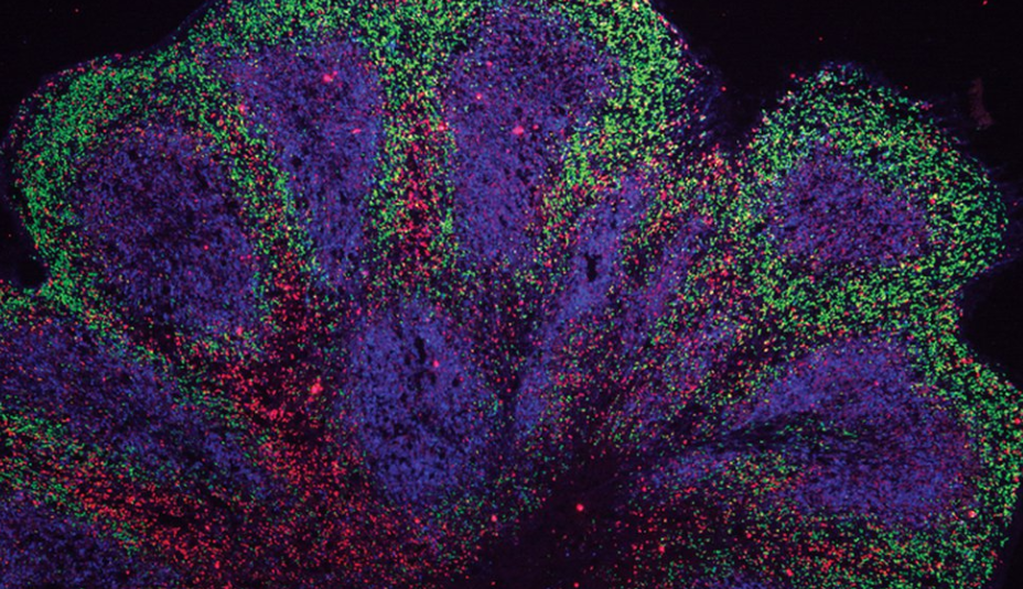 Crean “mini cerebros” de laboratorio para el tratamiento de enfermedades neurodegenerativas