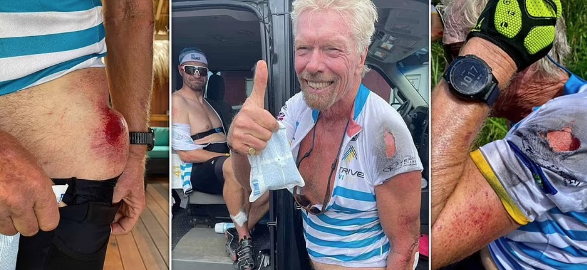 El magnate Richard Branson sufrió múltiples lesiones tras “colosal” accidente de ciclismo (FOTOS)