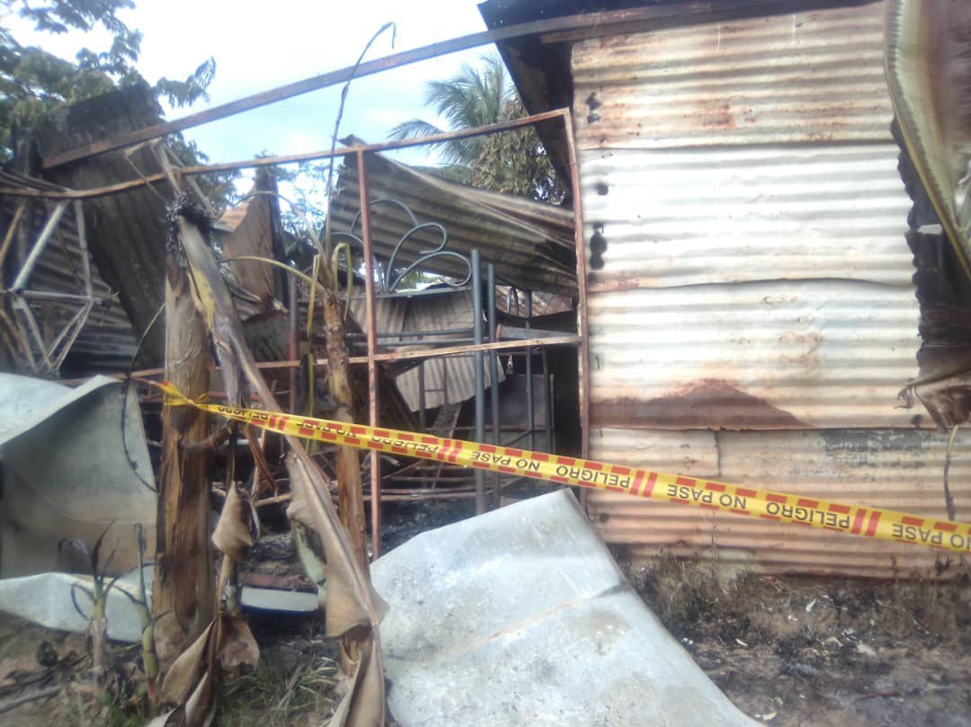 Bajo investigación padres de niños quemados en Guasdualito a causa de aparente “descuido”