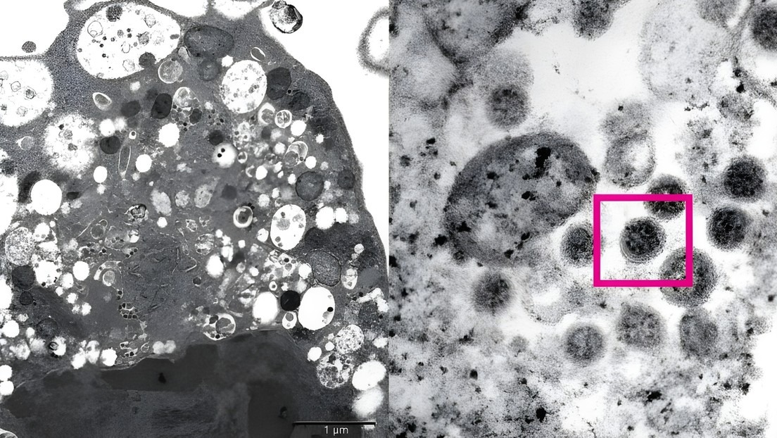 Qué se sabe de la nueva versión de la variante ómicron, que podría ser 1,5 veces más infecciosa que su predecesora