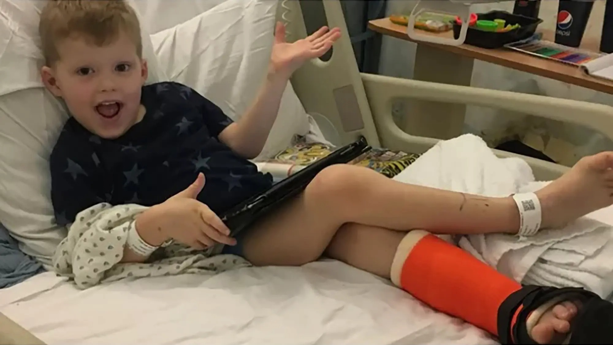 El niño que no puede sentir dolor: Caminó sobre una pierna rota durante días