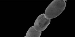 Alerta en una isla caribeña: Descubren la bacteria más grande del mundo, es 5 mil veces mayor a lo normal