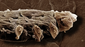 Microscópicos, así son los ácaros que viven en los poros del rostro (FOTOS)