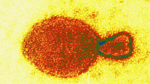 Todo lo que se sabe por ahora sobre “Langya”, el nuevo virus surgido en China y salto a los seres humanos