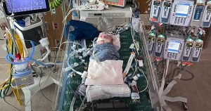 El primer trasplante de corazón parcial del mundo con tejido vivo salvó a un bebé recién nacido en EEUU