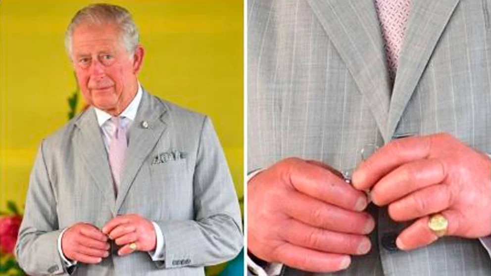 Las manos hinchadas del rey Carlos III: qué dicen los especialistas sobre la llamativa inflamación