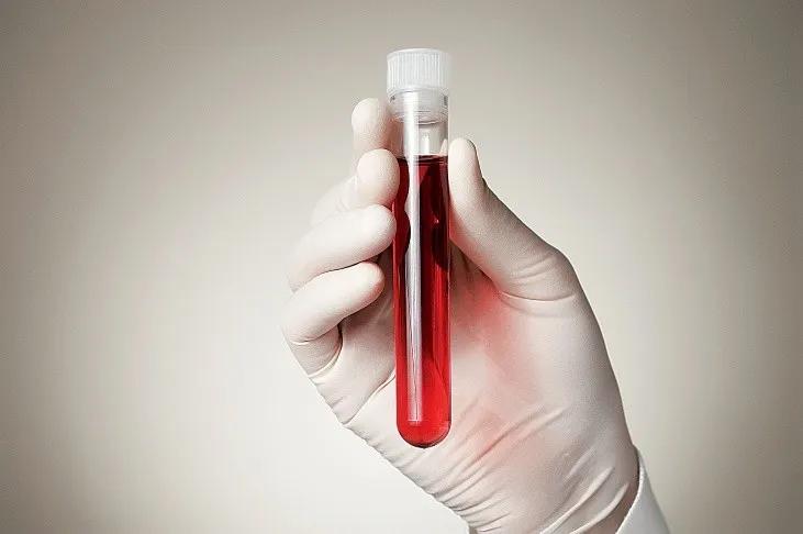Asociación Venezolana para la Hemofilia solicita al chavismo dotación de reactivos para despistaje