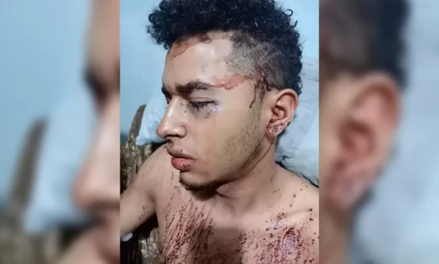 Injusticia en Perú: se orinaron la moto de un venezolano y le apuñalaron por reclamarles
